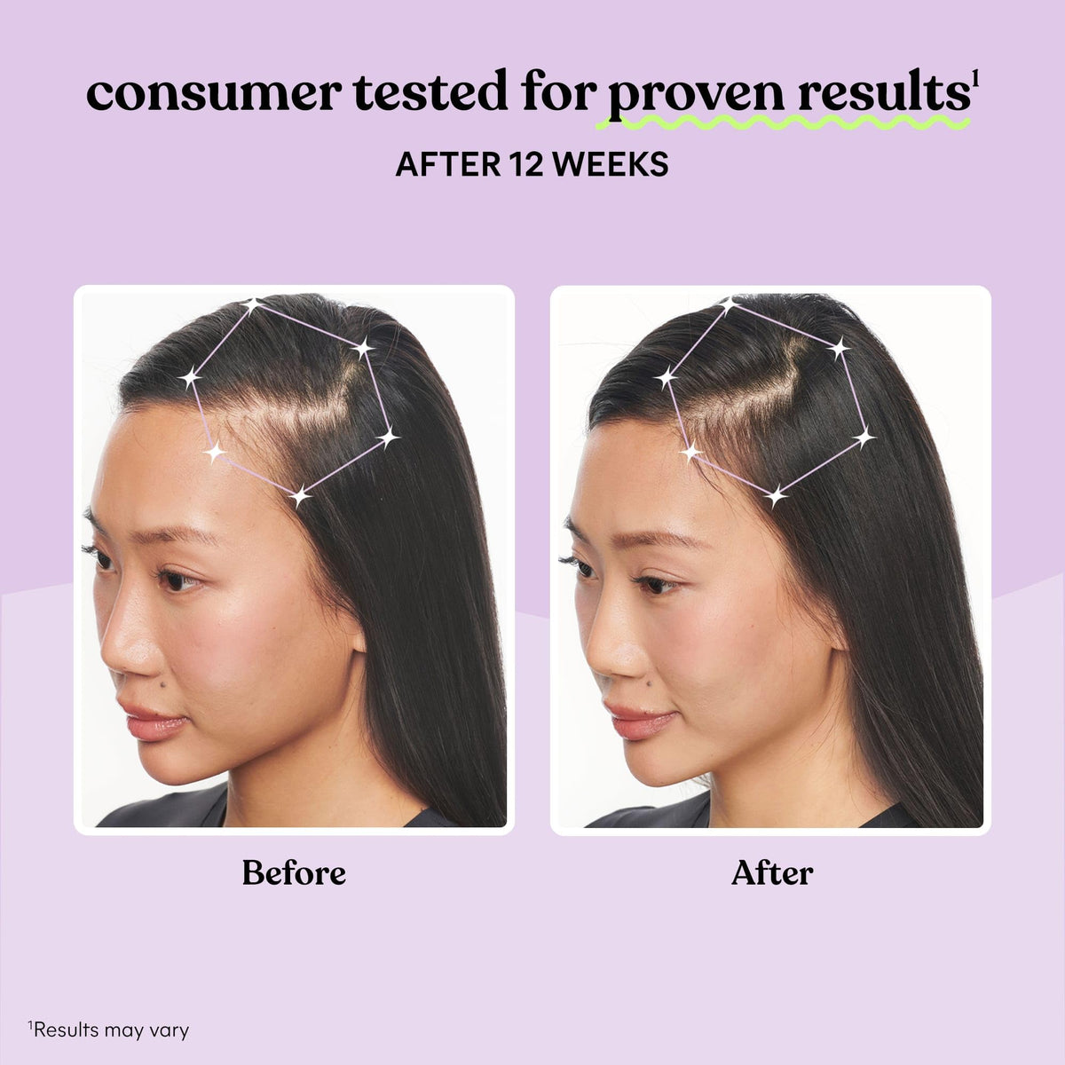 Hair Growth Capsules 30-Day Supply P7816
