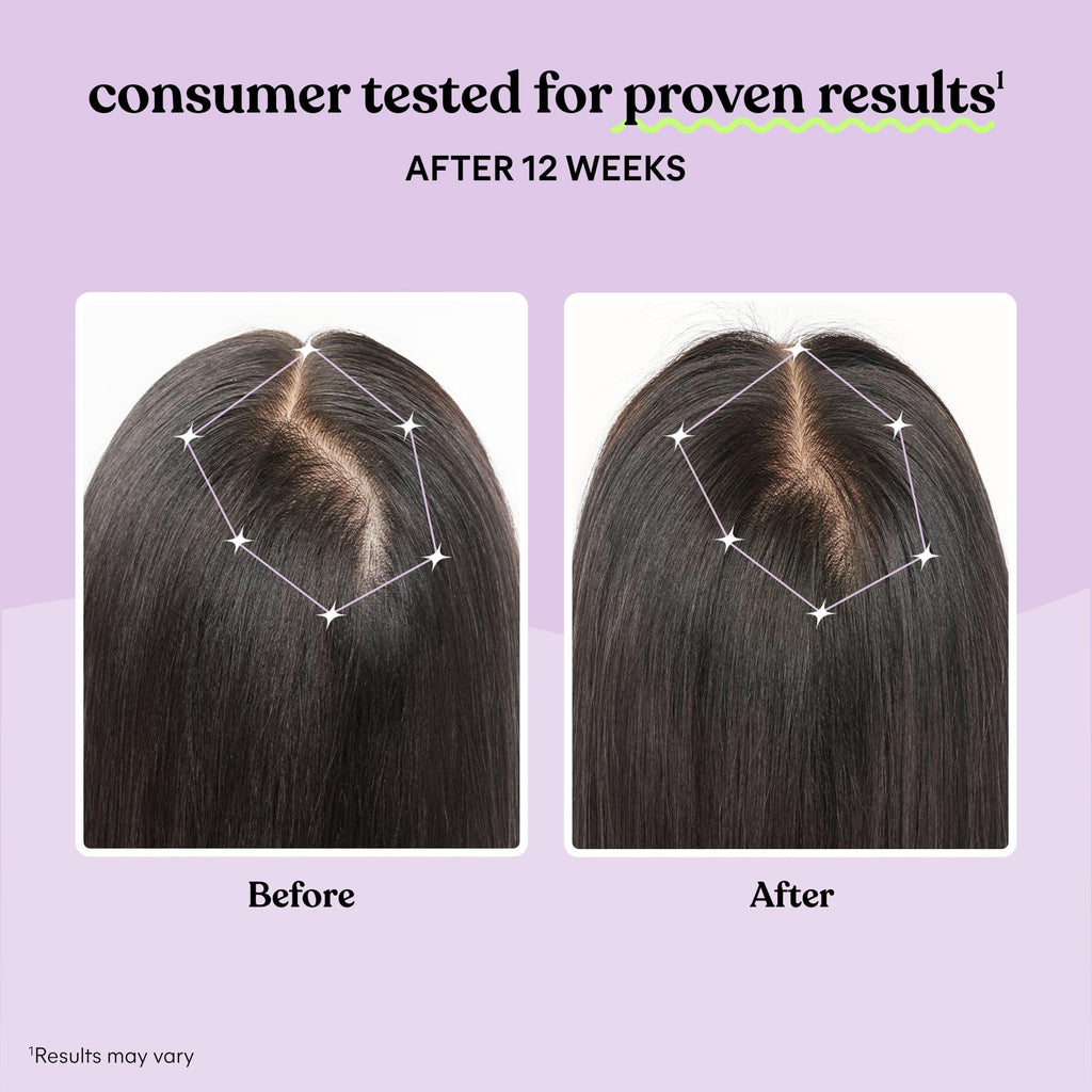 Hair Growth Capsules 30-Day Supply P7816